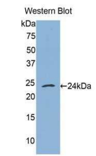 TNFRSF1A / TNFR1 Antibody - Western blot of recombinant TNFRSF1A / TNFR1.  This image was taken for the unconjugated form of this product. Other forms have not been tested.