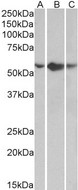TNFRSF1A / TNFR1 Antibody - Goat Anti-TNFRSF1A Antibody (0.5µg/ml) staining of A549 (A), HepG2 (B) and K562 (C) lysates (35µg protein in RIPA buffer). Primary incubation was 1 hour. Detected by chemiluminescencence.