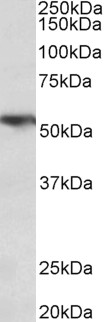 TNFRSF1A / TNFR1 Antibody - TNFRSF1A antibody (0.3 ug/ml) staining of Human Lung lysate (35 ug protein in RIPA buffer). Primary incubation was 1 hour. Detected by chemiluminescence.