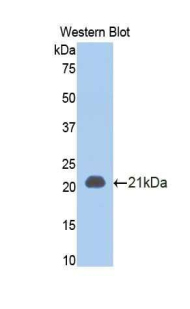 TNFRSF1A / TNFR1 Antibody - Western blot of recombinant TNFRSF1A / TNFR1.  This image was taken for the unconjugated form of this product. Other forms have not been tested.