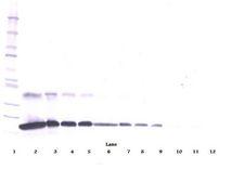 TNFRSF1A / TNFR1 Antibody - Western Blot (reducing) of TNFRSF1A / TNFR1 antibody
