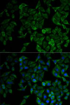 TNFRSF1A / TNFR1 Antibody - Immunofluorescence analysis of HeLa cells using TNFRSF1A antibody and counter-stained with DAPI for nuclear staining.