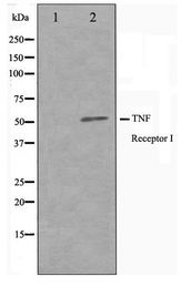 TNFRSF1A / TNFR1 Antibody - Western blot of TNRF1 antibody