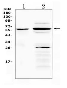 TNFRSF1A / TNFR1 Antibody - Western blot analysis of TNFRSF1A using anti-TNFRSF1A antibody. Electrophoresis was performed on a 5-20% SDS-PAGE gel at 70V (Stacking gel) / 90V (Resolving gel) for 2-3 hours. The sample well of each lane was loaded with 50ug of sample under reducing conditions. Lane 1: rat gaster tissue lysates, Lane 2: mouse brain tissue lysates. After Electrophoresis, proteins were transferred to a Nitrocellulose membrane at 150mA for 50-90 minutes. Blocked the membrane with 5% Non-fat Milk/ TBS for 1.5 hour at RT. The membrane was incubated with rabbit anti-TNFRSF1A antigen affinity purified polyclonal antibody at 0.5 µg/mL overnight at 4°C, then washed with TBS-0.1% Tween 3 times with 5 minutes each and probed with a goat anti-rabbit IgG-HRP secondary antibody at a dilution of 1:10000 for 1.5 hour at RT. The signal is developed using an Enhanced Chemiluminescent detection (ECL) kit with Tanon 5200 system. A specific band was detected for TNFRSF1A at approximately 60KD. The expected band size for TNFRSF1A is at 50KD.