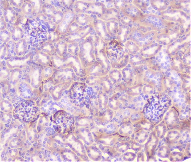 TNFRSF1A / TNFR1 Antibody - IHC analysis of TNF Receptor I using anti-TNF Receptor I antibody. TNF Receptor I was detected in paraffin-embedded section of mouse kidney tissue. Heat mediated antigen retrieval was performed in citrate buffer (pH6, epitope retrieval solution) for 20 mins. The tissue section was blocked with 10% goat serum. The tissue section was then incubated with 1µg/ml rabbit anti-TNF Receptor I Antibody overnight at 4°C. Biotinylated goat anti-rabbit IgG was used as secondary antibody and incubated for 30 minutes at 37°C. The tissue section was developed using Strepavidin-Biotin-Complex (SABC) with DAB as the chromogen.