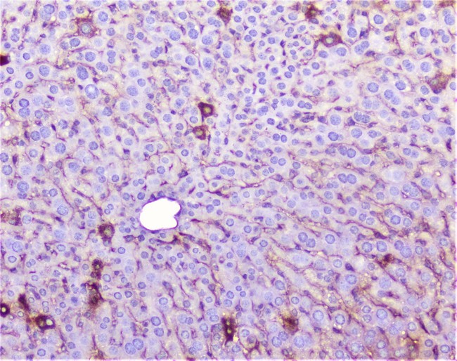 TNFRSF1A / TNFR1 Antibody - IHC analysis of TNF Receptor I using anti-TNF Receptor I antibody. TNF Receptor I was detected in paraffin-embedded section of mouse liver tissue. Heat mediated antigen retrieval was performed in citrate buffer (pH6, epitope retrieval solution) for 20 mins. The tissue section was blocked with 10% goat serum. The tissue section was then incubated with 1µg/ml rabbit anti-TNF Receptor I Antibody overnight at 4°C. Biotinylated goat anti-rabbit IgG was used as secondary antibody and incubated for 30 minutes at 37°C. The tissue section was developed using Strepavidin-Biotin-Complex (SABC) with DAB as the chromogen.