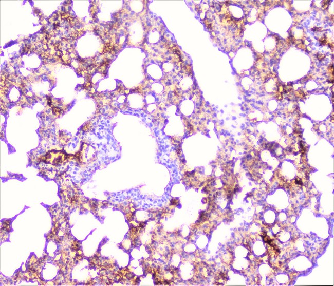 TNFRSF1A / TNFR1 Antibody - IHC analysis of TNF Receptor I using anti-TNF Receptor I antibody. TNF Receptor I was detected in paraffin-embedded section of mouse lung tissue. Heat mediated antigen retrieval was performed in citrate buffer (pH6, epitope retrieval solution) for 20 mins. The tissue section was blocked with 10% goat serum. The tissue section was then incubated with 1µg/ml rabbit anti-TNF Receptor I Antibody overnight at 4°C. Biotinylated goat anti-rabbit IgG was used as secondary antibody and incubated for 30 minutes at 37°C. The tissue section was developed using Strepavidin-Biotin-Complex (SABC) with DAB as the chromogen.