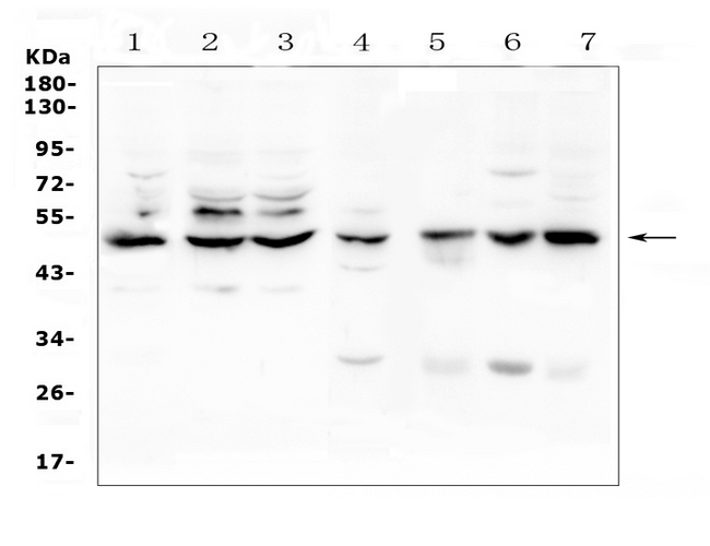 TNFRSF1A / TNFR1 Antibody - Western blot analysis of TNF Receptor I? using anti-TNF Receptor I? antibody. Electrophoresis was performed on a 5-20% SDS-PAGE gel at 70V (Stacking gel) / 90V (Resolving gel) for 2-3 hours. The sample well of each lane was loaded with 50ug of sample under reducing conditions. Lane 1: human Hela whole cell lysate,Lane 2: human K562 whole cell lysate,Lane 3: human Caco-2 whole cell lysate,Lane 4: rat liver tissue lysates,Lane 5: mouse small intestine tissue lysates,Lane 6: mouse liver tissue lysates,Lane 7: mouse HEPA1-6 whole cell lysate. After Electrophoresis, proteins were transferred to a Nitrocellulose membrane at 150mA for 50-90 minutes. Blocked the membrane with 5% Non-fat Milk/ TBS for 1.5 hour at RT. The membrane was incubated with rabbit anti-TNF Receptor I? antigen affinity purified polyclonal antibody at 0.5 µg/mL overnight at 4°C, then washed with TBS-0.1% Tween 3 times with 5 minutes each and probed with a goat anti-rabbit IgG-HRP secondary antibody at a dilution of 1:10000 for 1.5 hour at RT. The signal is developed using an Enhanced Chemiluminescent detection (ECL) kit with Tanon 5200 system. A specific band was detected for TNF Receptor I? at approximately 50KD. The expected band size for TNF Receptor I? is at 50KD.