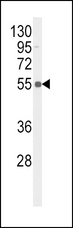 TNFRSF1A / TNFR1 Antibody - Western blot of hTNFR-pS274 in MDA-MB468 cell line lysates (35 ug/lane). TNFR (arrow) was detected using the purified antibody.