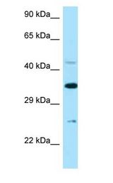 TNFRSF1B / TNFR2 Antibody - TNFRSF1B / TNFR2 / p75 antibody Western Blot of OVCAR-3.  This image was taken for the unconjugated form of this product. Other forms have not been tested.