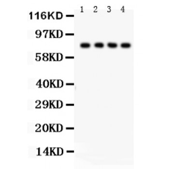 TNFRSF1B / TNFR2 Antibody - TNF Receptor II antibody Western blot. All lanes: Anti TNF Receptor II at 0.5 ug/ml. Lane 1: Rat Thymus Tissue Lysate at 50 ug. Lane 2: Rat Liver Tissue Lysate at 50 ug. Lane 3: HELA Whole Cell Lysate at 40 ug. Lane 4: A549 Whole Cell Lysate at 40 ug. Predicted band size: 75 kD. Observed band size: 75 kD.