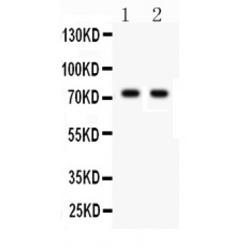 TNFRSF1B / TNFR2 Antibody - TNF Receptor II antibody Western blot. All lanes: Anti TNF Receptor II at 0.5 ug/ml. Lane 1: Rat Thymus Tissue Lysate at 50 ug. Lane 2: Mouse Thymus Tissue Lysate at 50 ug. Predicted band size: 75 kD. Observed band size: 75 kD.