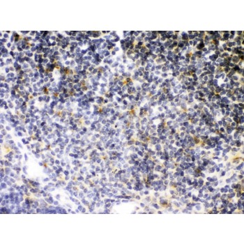 TNFRSF1B / TNFR2 Antibody - TNF Receptor II antibody IHC-paraffin. IHC(P): Mouse Thymus Tissue.