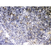 TNFRSF1B / TNFR2 Antibody - TNF Receptor II antibody IHC-paraffin. IHC(P): Mouse Thymus Tissue.
