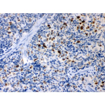 TNFRSF1B / TNFR2 Antibody - TNF Receptor II antibody IHC-paraffin. IHC(P): Rat Spleen Tissue.