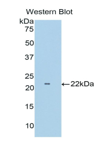 TNFRSF1B / TNFR2 Antibody - Western blot of recombinant TNFRSF1B / TNFR2 / p75.  This image was taken for the unconjugated form of this product. Other forms have not been tested.