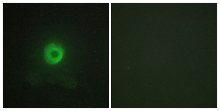 TNFRSF1B / TNFR2 Antibody - Immunofluorescence analysis of HeLa cells, using TNF Receptor II Antibody. The picture on the right is blocked with the synthesized peptide.