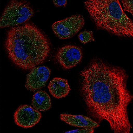 TNFRSF1B / TNFR2 Antibody - Immunofluorescent staining of PC3 cells with Rabbit anti-Human CD120b , green. Counterstained with actin, red and nuclei, blue.  This image was taken for the unconjugated form of this product. Other forms have not been tested.