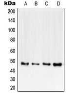 TNFRSF1B / TNFR2 Antibody - Western blot analysis of CD120b expression in HEK293T (A); mouse heart (B); rat heart (C); PC12 (D) whole cell lysates.