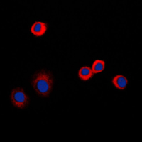 TNFRSF1B / TNFR2 Antibody - Immunofluorescent analysis of CD120b staining in PC12 cells. Formalin-fixed cells were permeabilized with 0.1% Triton X-100 in TBS for 5-10 minutes and blocked with 3% BSA-PBS for 30 minutes at room temperature. Cells were probed with the primary antibody in 3% BSA-PBS and incubated overnight at 4 C in a humidified chamber. Cells were washed with PBST and incubated with a DyLight 594-conjugated secondary antibody (red) in PBS at room temperature in the dark. DAPI was used to stain the cell nuclei (blue).