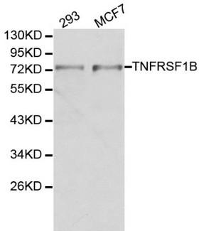 TNFRSF1B / TNFR2 Antibody - Western blot of TNFRSF1B pAb in extracts from 293 and MCF7 cells.