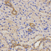 TNFRSF1B / TNFR2 Antibody - Immunohistochemistry of paraffin-embedded rat kidney tissue.