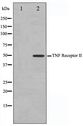 TNFRSF1B / TNFR2 Antibody - Western blot of LOVO cell lysate using TNF-R2 Antibody