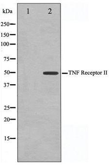 TNFRSF1B / TNFR2 Antibody - Western blot of LOVO cell lysate using TNF-R2 Antibody