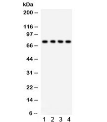 TNFRSF1B / TNFR2 Antibody
