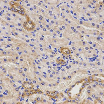 TNFRSF1B / TNFR2 Antibody - Immunohistochemistry of paraffin-embedded rat kidney using TNFRSF1B antibody at dilution of 1:200 (40x lens).