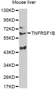 TNFRSF1B / TNFR2 Antibody - Western blot analysis of extracts of mouse liver, using TNFRSF1B antibody at 1:1000 dilution. The secondary antibody used was an HRP Goat Anti-Rabbit IgG (H+L) at 1:10000 dilution. Lysates were loaded 25ug per lane and 3% nonfat dry milk in TBST was used for blocking.