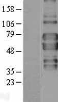 TNFRSF1B / TNFR2 Protein - Western validation with an anti-DDK antibody * L: Control HEK293 lysate R: Over-expression lysate