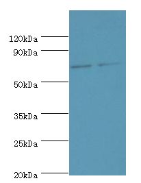 TNFRSF21 / DR6 Antibody - Western blot. All lanes: TNFRSF21 antibody at 4 ug/ml. Lane 1: K562 whole cell lysate. Lane 2: Jurkat whole cell lysate. Secondary antibody: Goat polyclonal to rabbit at 1:10000 dilution. Predicted band size: 72 kDa. Observed band size: 72 kDa.
