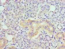 TNFRSF21 / DR6 Antibody - Immunohistochemistry of paraffin-embedded human pancreas using antibody at 1:100 dilution.