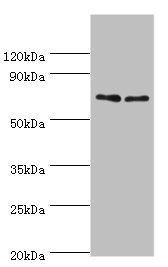 TNFRSF21 / DR6 Antibody - Western blot All lanes: TNFRSF21 antibody at 4µg/ml Lane 1: K562 whole cell lysate Lane 2: Jurkat whole cell lysate Secondary Goat polyclonal to rabbit IgG at 1/10000 dilution Predicted band size: 72 kDa Observed band size: 72 kDa
