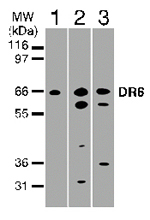 TNFRSF21 / DR6 Antibody - Western blot of 30 ug of total cell lysate from Jurkat (lane 1), HeLa (lane 2), and Daudi (lane 3) cells with antibody at 2 ug/ml.