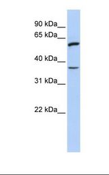 TNFRSF21 / DR6 Antibody - 721_B cell lysate. Antibody concentration: 1.0 ug/ml. Gel concentration: 12%.  This image was taken for the unconjugated form of this product. Other forms have not been tested.