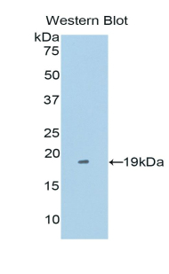 TNFRSF21 / DR6 Antibody - Western blot of recombinant TNFRSF21 / DR6.  This image was taken for the unconjugated form of this product. Other forms have not been tested.