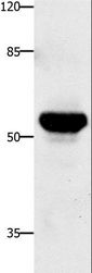 TNFRSF21 / DR6 Antibody - Western blot analysis of Human fetal brain tissue, using TNFRSF21 Polyclonal Antibody at dilution of 1:420.