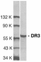TNFRSF25 / DR3 Antibody - Western blot of whole cell lysate from Jurkat cells probed with Rabbit anti-Human DR3 (RABBIT ANTI HUMAN DR3 (N-TERMINAL)).
