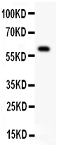 TNFRSF25 / DR3 Antibody - anti-DR3 antibody, Western blotting All lanes: Anti DR3 at 0.5ug/mlWB: COLO320 Whole Cell Lysate at 40ugPredicted bind size: 59KD Observed bind size: 59KD