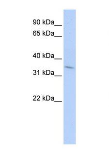 TNFRSF25 / DR3 Antibody - TNFRSF25 / DR3 antibody Western blot of HepG2 Cell lysate. Antibody concentration 1 ug/ml. This image was taken for the unconjugated form of this product. Other forms have not been tested.