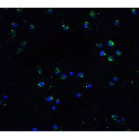 TNFRSF25 / DR3 Antibody - Immunofluorescence of DR3 in Jurkat cells with DR3 antibody at 20 µg/mL.Green: DR3 Antibody  Blue: DAPI staining