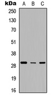 TNFRSF4 / CD134 / OX40 Antibody - Western blot analysis of CD134 expression in HEK293T (A); Raw264.7 (B); H9C2 (C) whole cell lysates.