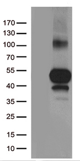 TNFRSF4 / CD134 / OX40 Antibody - HEK293T cells were transfected with the pCMV6-ENTRY control. (Left lane) or pCMV6-ENTRY TNFRSF4. (Right lane) cDNA for 48 hrs and lysed