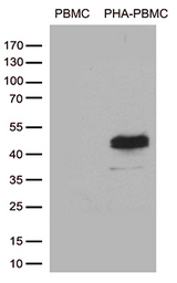 TNFRSF4 / CD134 / OX40 Antibody - Western blot analysis of extracts. (35ug) from PBMCs and PHA-PBMCs. (stimulated by 10ug/ml PHA for 72h) by using anti-TNFRSF4 monoclonal antibody. (1:500)