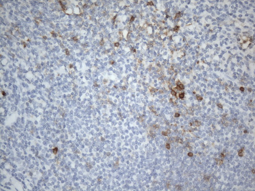 TNFRSF4 / CD134 / OX40 Antibody - Immunohistochemical staining of paraffin-embedded Human tonsil within the normal limits using anti-OX40(TNFRSF4) mouse monoclonal antibody. (Heat-induced epitope retrieval by 1mM EDTA in 10mM Tris buffer. (pH8.0) at 120°C for 2.5 min. (1:300)