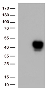TNFRSF4 / CD134 / OX40 Antibody - HEK293T cells were transfected with the pCMV6-ENTRY control. (Left lane) or pCMV6-ENTRY TNFRSF4. (Right lane) cDNA for 48 hrs and lysed. Equivalent amounts of cell lysates. (5 ug per lane) were separated by SDS-PAGE and immunoblotted with anti-TNFRSF4. (1:1000)