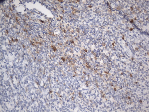TNFRSF4 / CD134 / OX40 Antibody - Immunohistochemical staining of paraffin-embedded Human tonsil within the normal limits using anti-OX40(TNFRSF4) mouse monoclonal antibody. (Heat-induced epitope retrieval by 1mM EDTA in 10mM Tris buffer. (pH8.0) at 120°C for 2.5 min. (1:50)