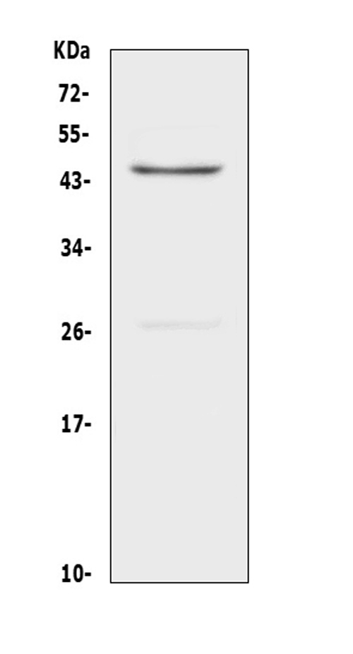 TNFRSF4 / CD134 / OX40 Antibody - Western blot analysis of CD134/OX40 using anti-CD134/OX40 antibody. Electrophoresis was performed on a 5-20% SDS-PAGE gel at 70V (Stacking gel) / 90V (Resolving gel) for 2-3 hours. The sample well of each lane was loaded with 50ug of sample under reducing conditions. Lane 1: rat heart tissue lysates. After Electrophoresis, proteins were transferred to a Nitrocellulose membrane at 150mA for 50-90 minutes. Blocked the membrane with 5% Non-fat Milk/ TBS for 1.5 hour at RT. The membrane was incubated with rabbit anti-CD134/OX40 antigen affinity purified polyclonal antibody at 0.5 µg/mL overnight at 4°C, then washed with TBS-0.1% Tween 3 times with 5 minutes each and probed with a goat anti-rabbit IgG-HRP secondary antibody at a dilution of 1:10000 for 1.5 hour at RT. The signal is developed using an Enhanced Chemiluminescent detection (ECL) kit with Tanon 5200 system. A specific band was detected for CD134/OX40 at approximately 45KD. The expected band size for CD134/OX40 is at 29KD.